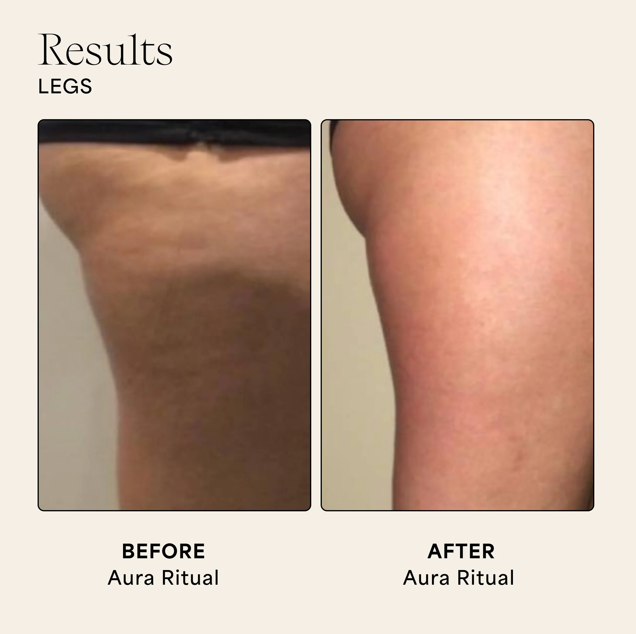 Aura Stone - Image 5