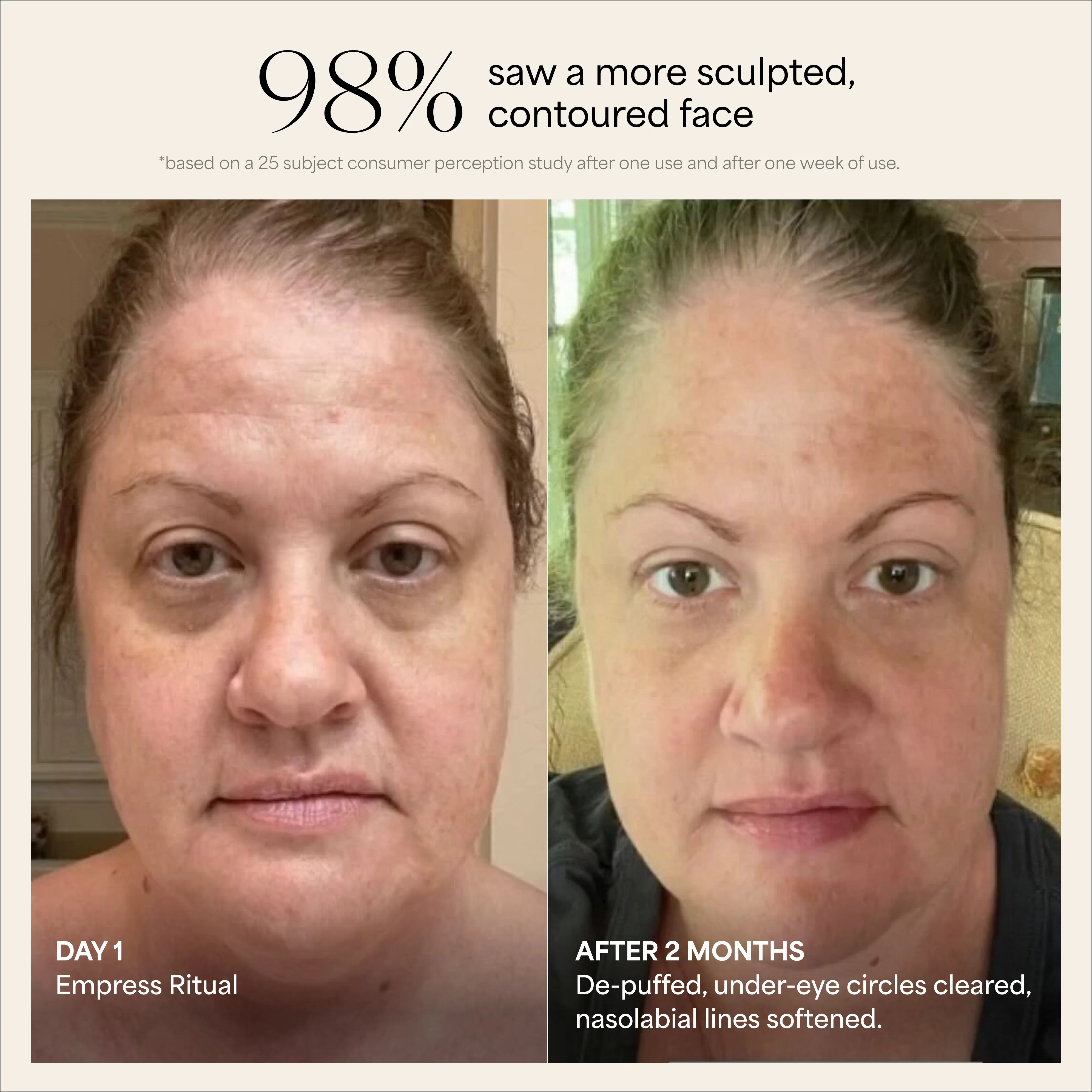 Empress Platinum - Image 4