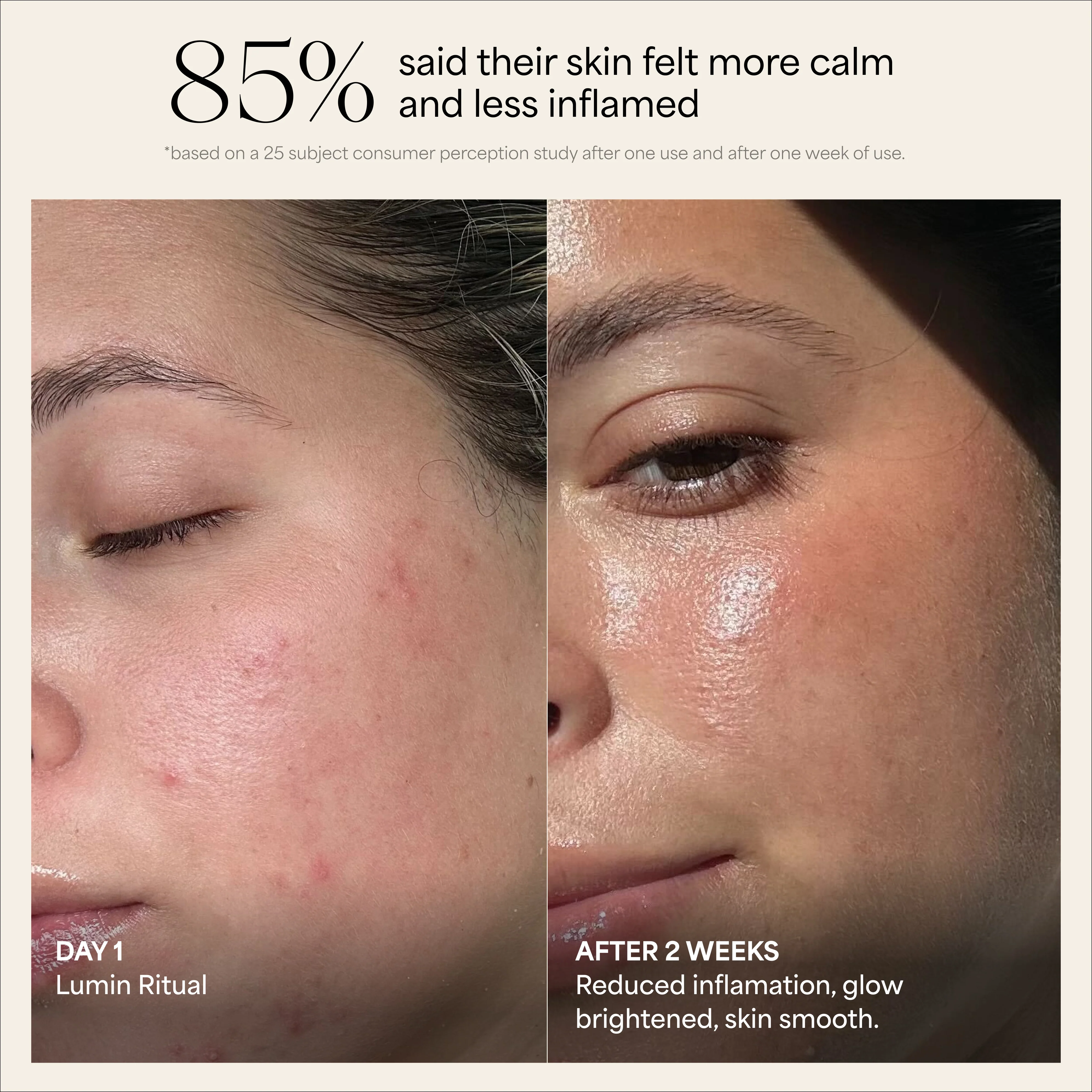 Lumin Cupping Set - Image 3